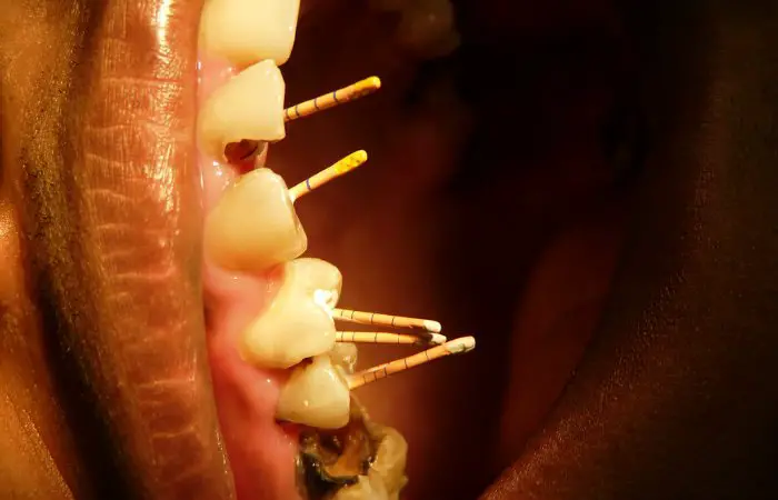 Endodoncia Ciencias Formales